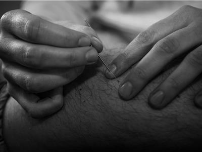 Dry Needling